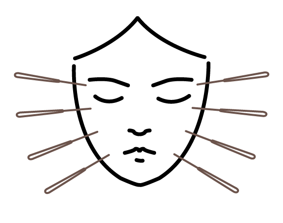 akupukntura-kosmetyczna2